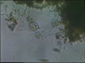 video pic