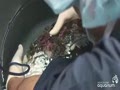 video pic